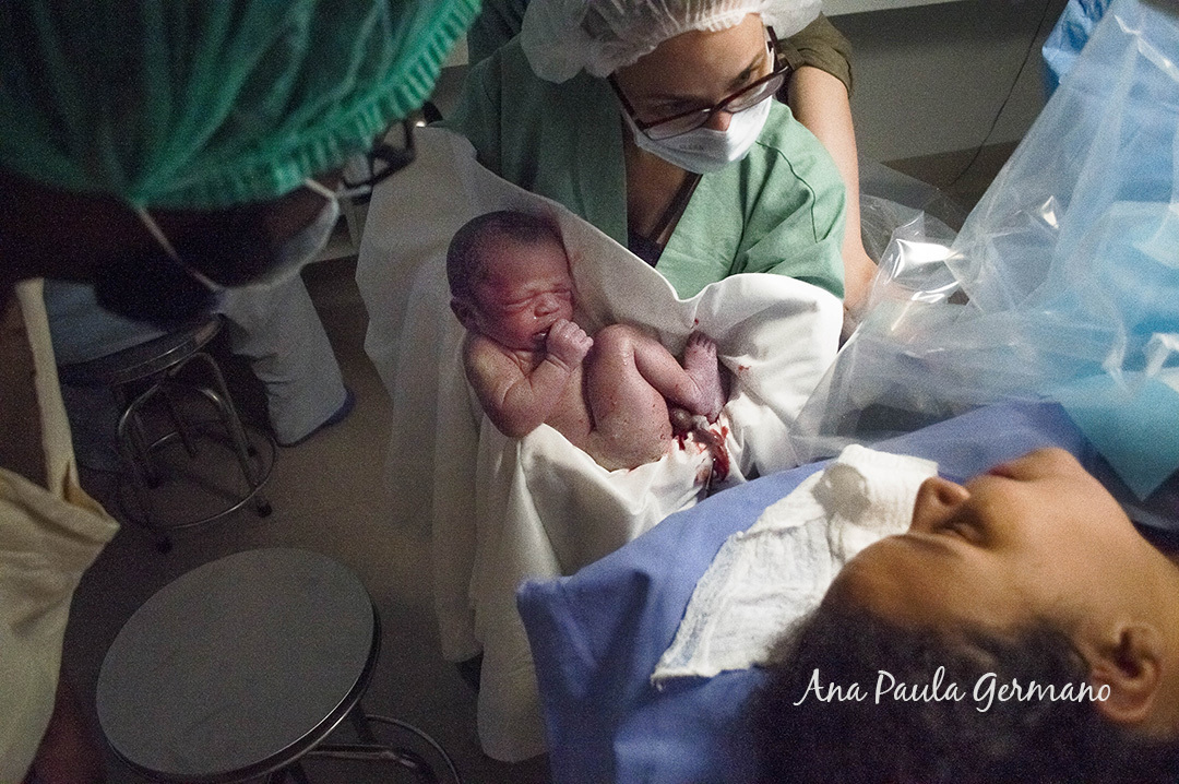 Registro de Parto - Fotografia e Filmagem - Maternidade Santa Joana 5