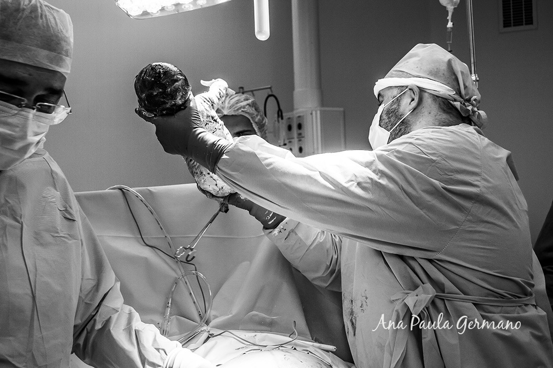 Hospital Sao Luiz Analia Franco-Fotografo de Parto/SP |nascimento do bebê Leonardo 18