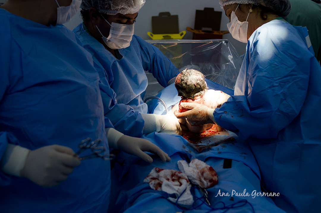 Fotografo de Parto SP | Pro Matre Paulista | Nascimento da Bebê Camila | 12