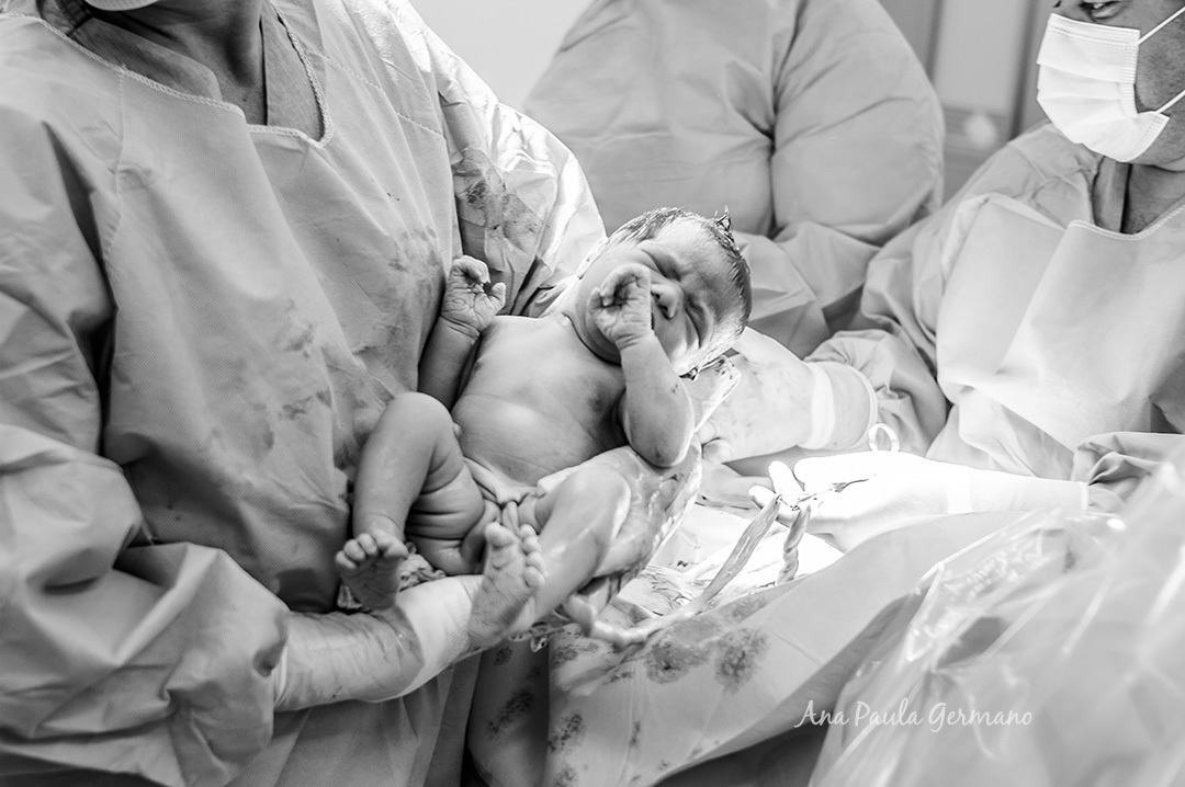 Fotografo de Parto SP | Pro Matre Paulista | Nascimento da Bebê Camila | 14
