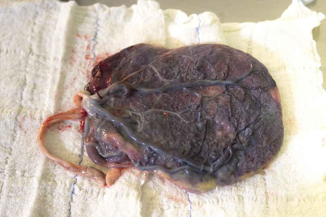 Fotografo de parto - Hospital São Luiz Itaim | 24