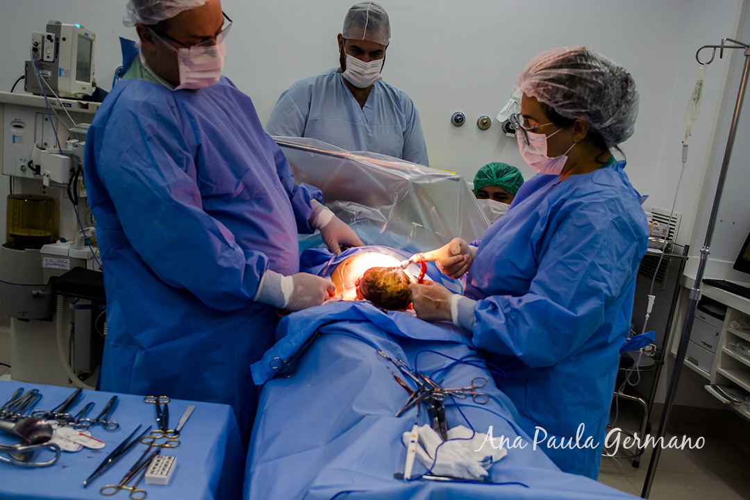 Fotografia de Parto - Maternidade Santa Joana - São Paulo/SP - O Nascimento da Isabella | 9