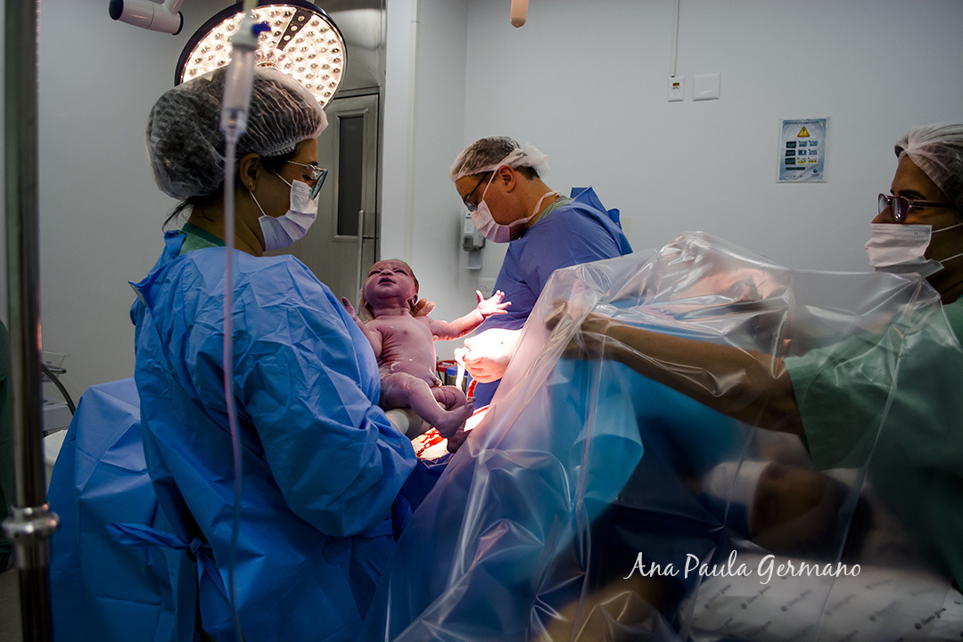 Fotografia de Parto - Maternidade Santa Joana - São Paulo/SP - O Nascimento da Isabella | 13