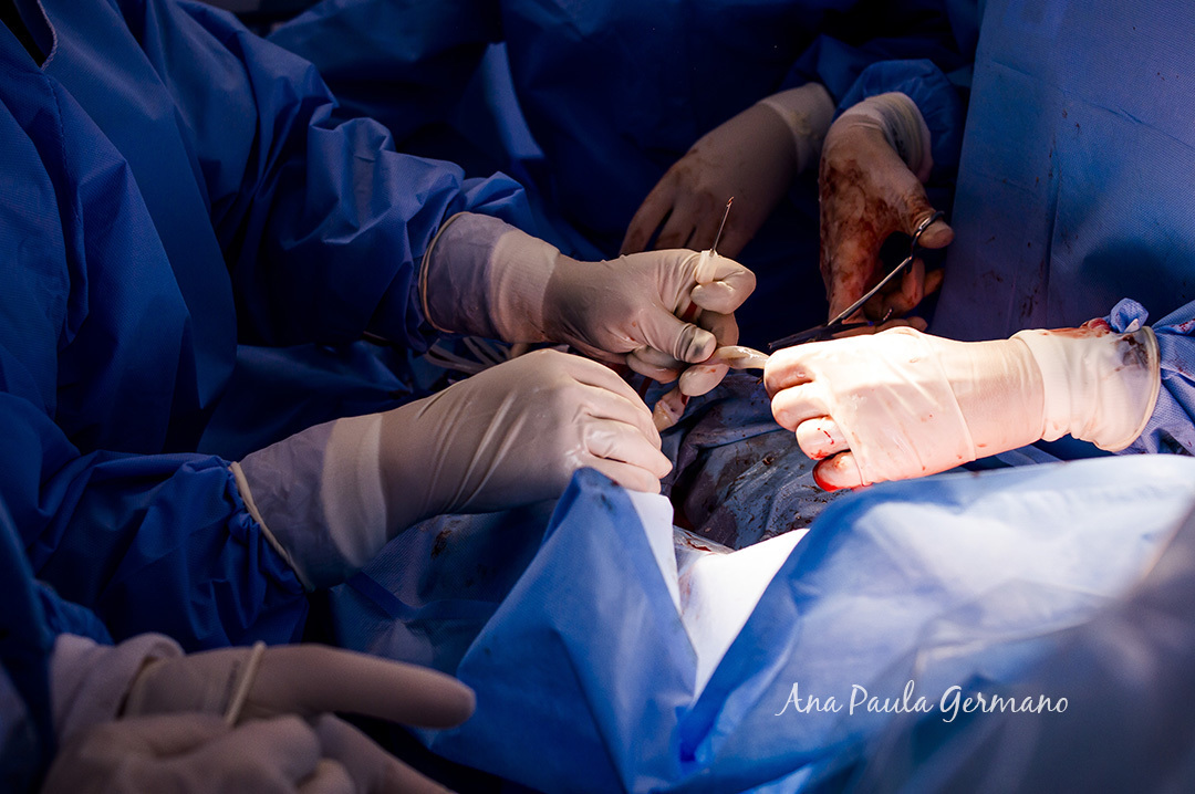 FOTOGRAFIA de PARTO/SP: Maternidade PRO MATRE Paulista - São Paulo/SP - NASCIMENTO do BEBÊ Bernardo - 36