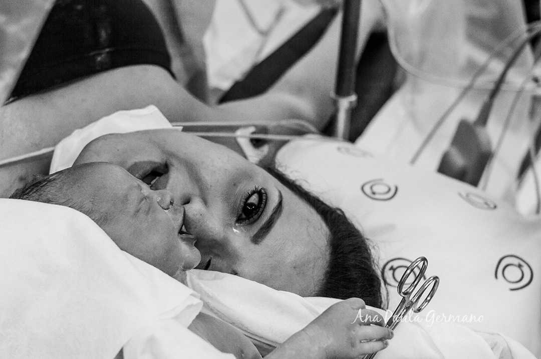 FOTOGRAFIA de PARTO/SP: Maternidade PRO MATRE Paulista - São Paulo/SP - NASCIMENTO do BEBÊ Bernardo - 38