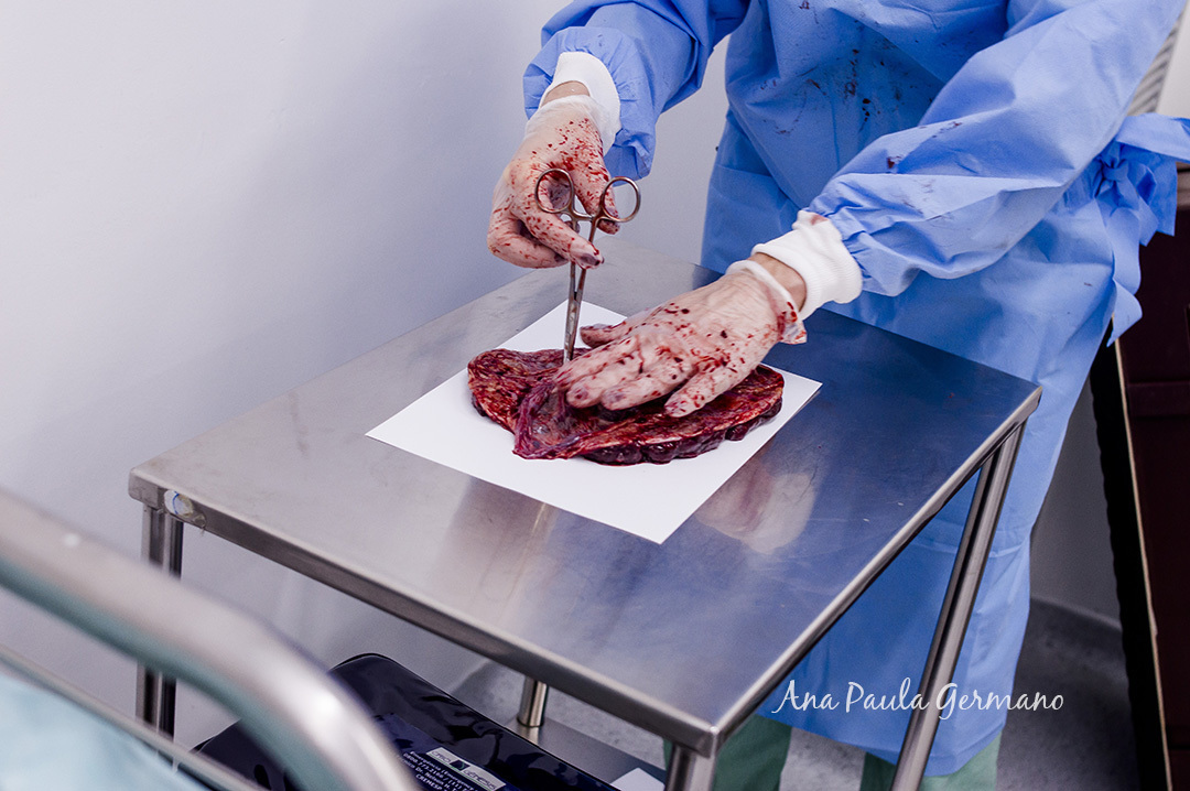 FOTOGRAFIA de PARTO/SP: Maternidade PRO MATRE Paulista - São Paulo/SP - NASCIMENTO do BEBÊ Bernardo - 54