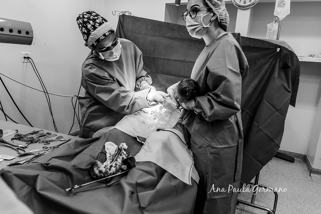 Hospital Cruz Azul Fotografo de Parto Credenciado | Nascimento da Alice | 12