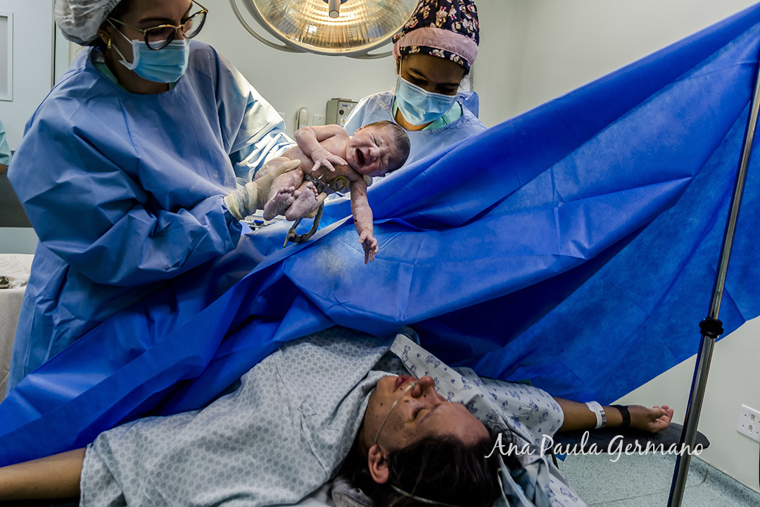 Hospital Cruz Azul Fotografo de Parto Credenciado | Nascimento da Alice | 13