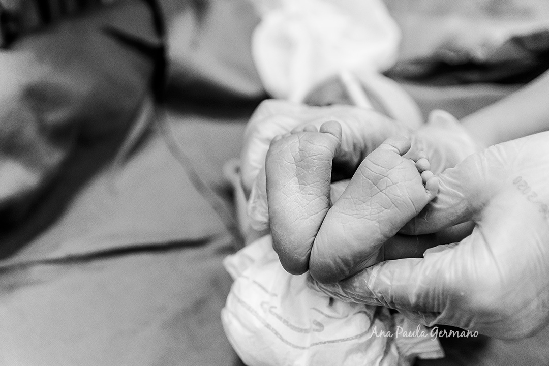 Fotografia | Parto Cesárea | Credenciados as Maternidades do ABC/SP (9)