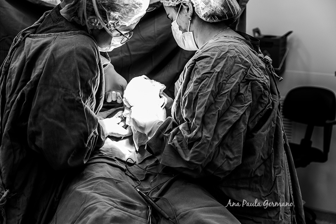 Fotógrafo de Parto credenciado ao Hospital Sepaco | Nascimento do Bebê Renan | 6