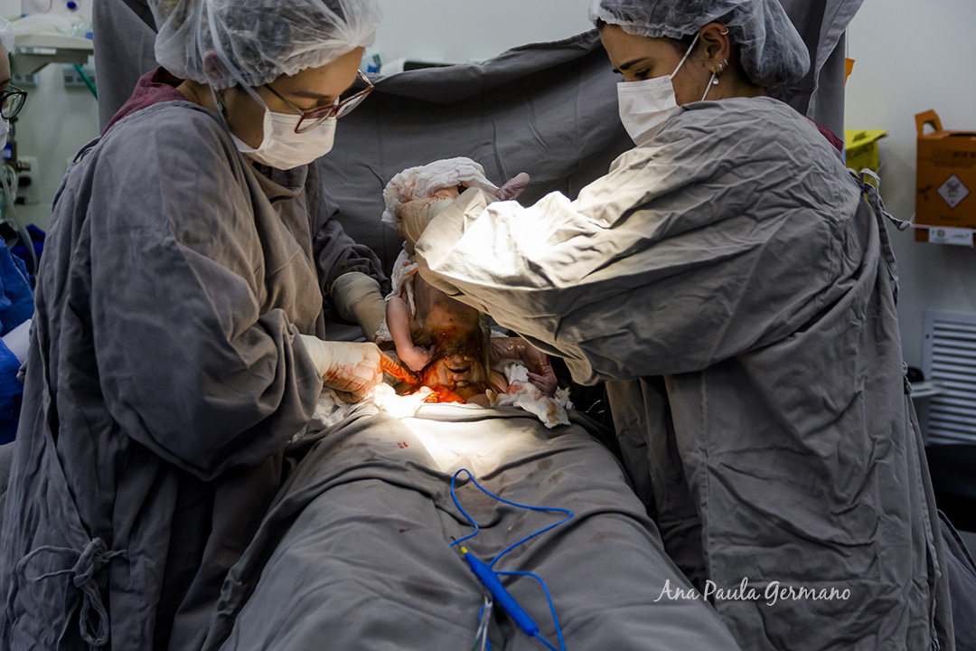 Fotógrafo de Parto credenciado ao Hospital Sepaco | Nascimento do Bebê Renan | 8