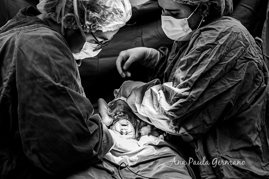 Fotógrafo de Parto credenciado ao Hospital Sepaco | Nascimento do Bebê Renan | 9