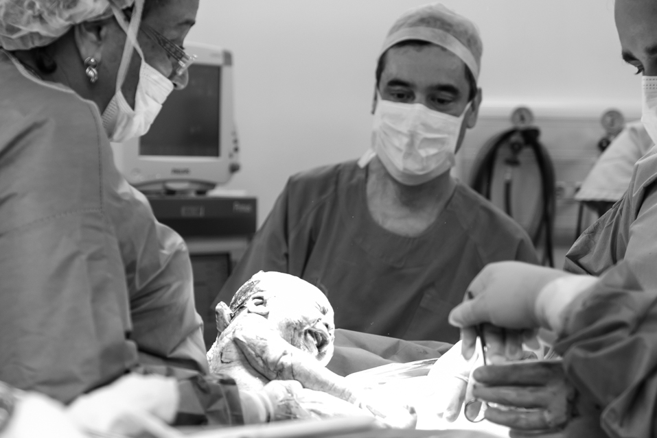 cobertura-parto-cesarea