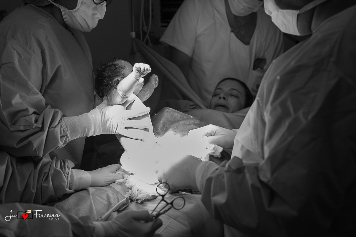 CESÁREA OU PARTO NORMAL