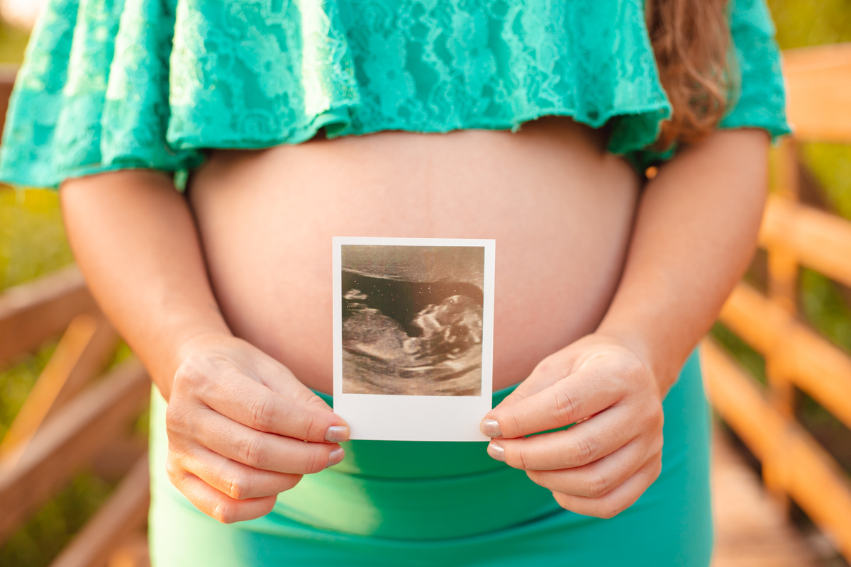 o que usar no ensaio de gestante, ensaio lindo de gestante, nascer do sol no campeche, gravida linda, gravida usando figurino da midora, gravida de preto, fotografa em floripa, usando a foto do ultrasson no ensaio de gestante, 