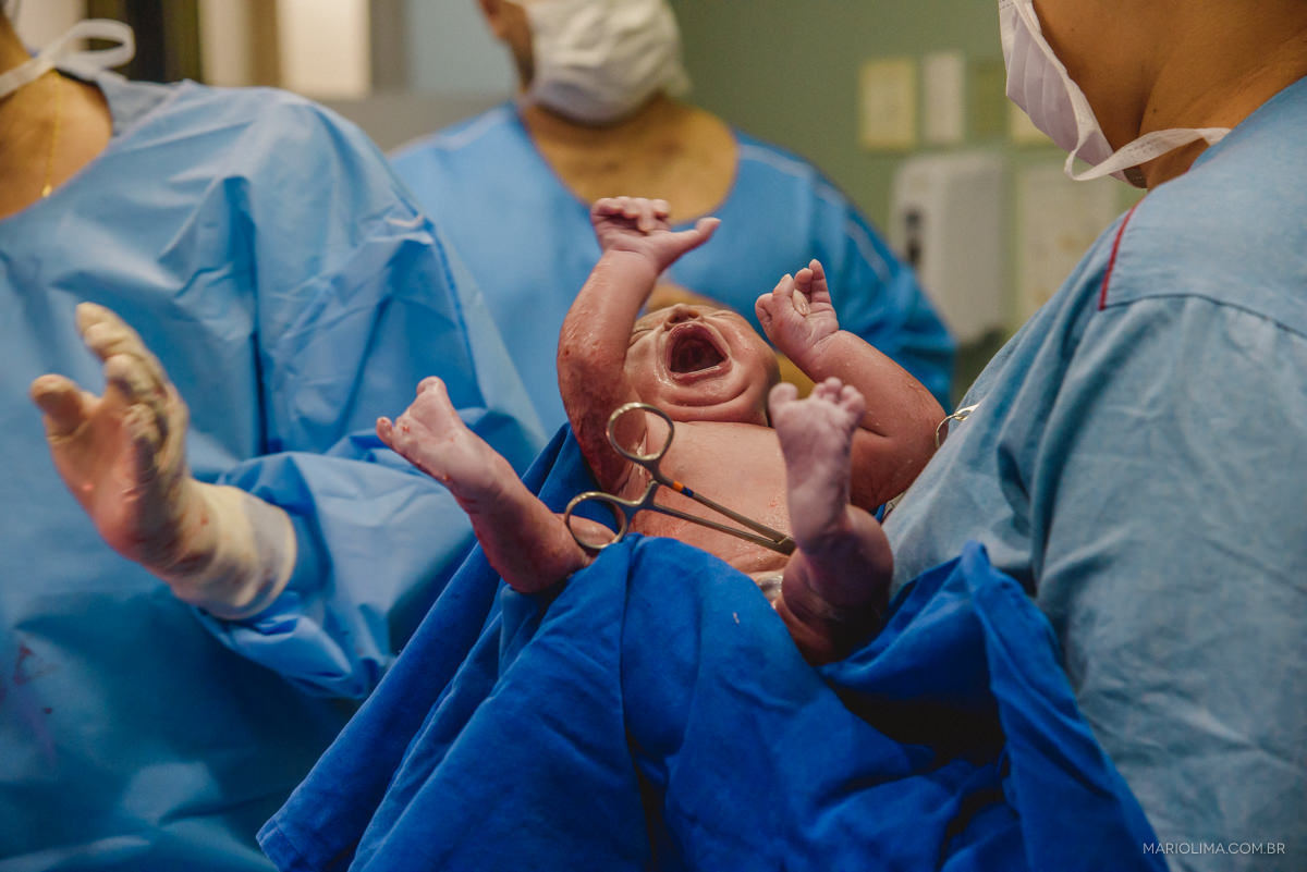 fotografia de parto na maternidade carlos chagas em guarulhos