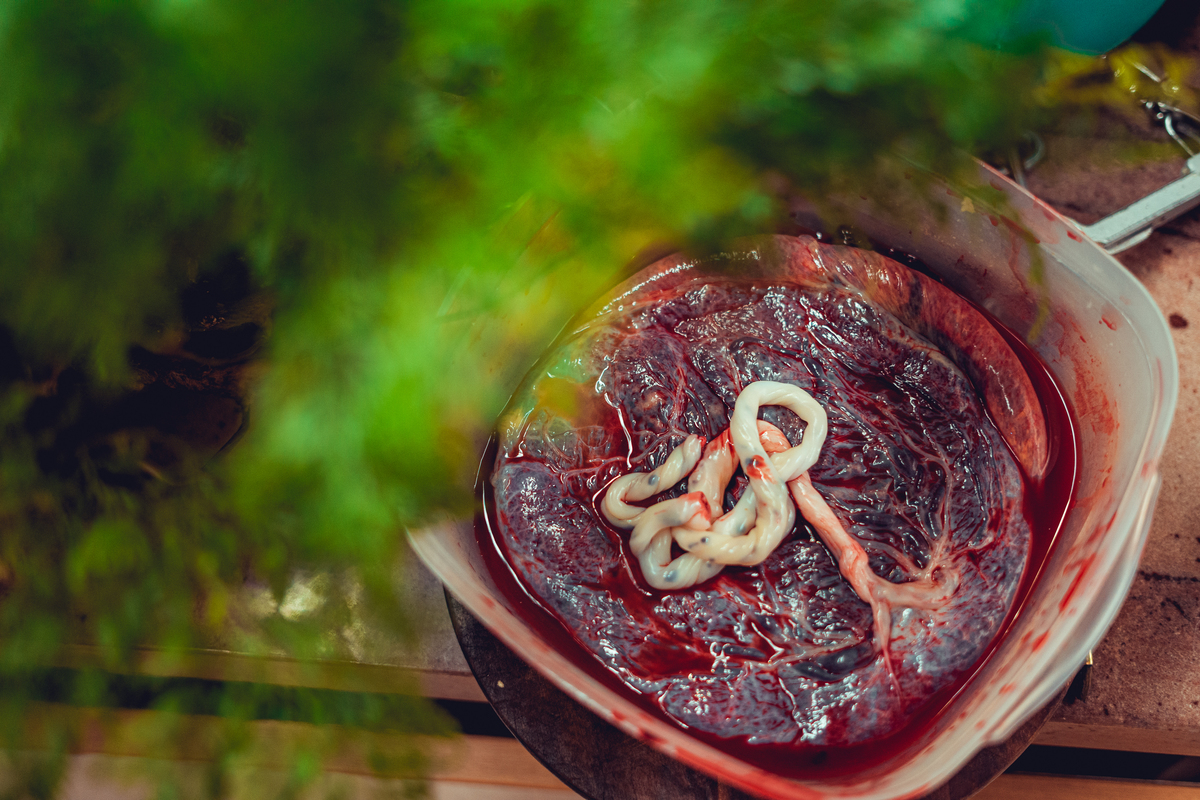 Senhoritas Fotografia Parto Humanizado Natural Salvador Obstetra Domiciliar