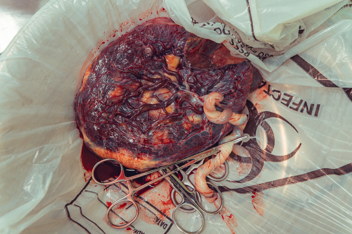 iluminare obstare parto normal hospital aliança natural humanizado adriana monteiro rodrigo lemos salvador doula nascimento senhoritas fotografia foto fotografa 