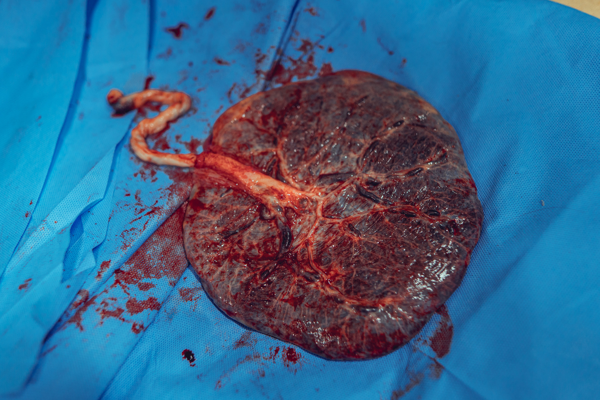 senhoritas fotografia documental parto normal natural humanizado hospitalar doula salvador bahia enfermeira obstetra nascimento bebê criança gravidez grávida gestante gestação