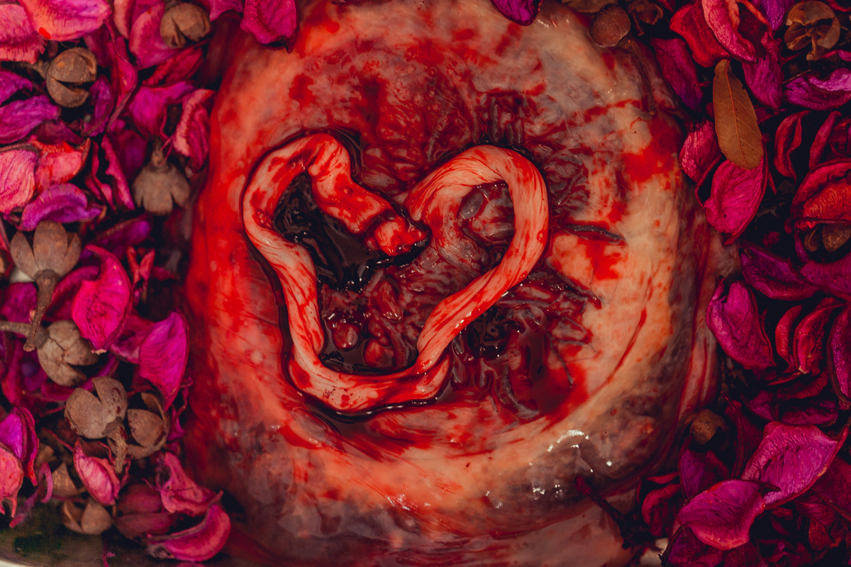 foto da placenta depois do parto domiciliar com cordão umbilical