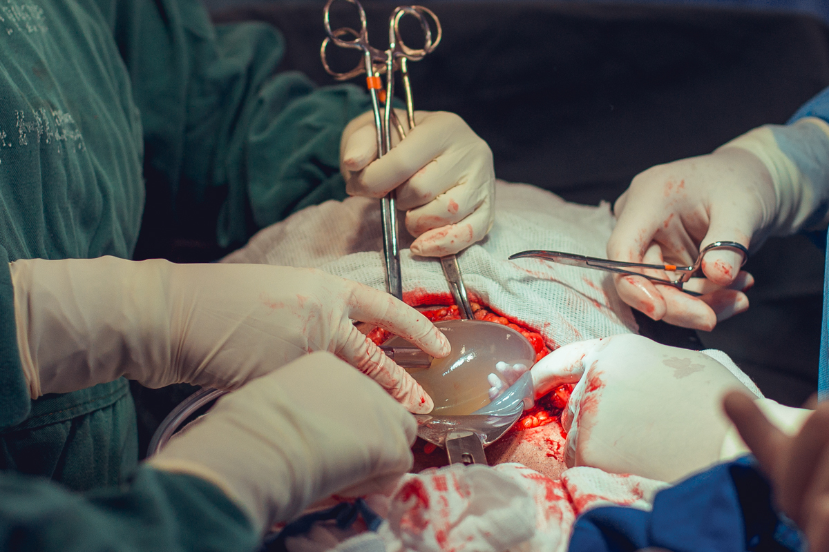 Eliomara Gomes eliomaria parto quadrigemeos riachao Maternidade de Referência José Maria de Magalhães Neto Senhoritas Fotografia Salvador 3 meninas e 1 menino Referencia Alto Risco Prematuro