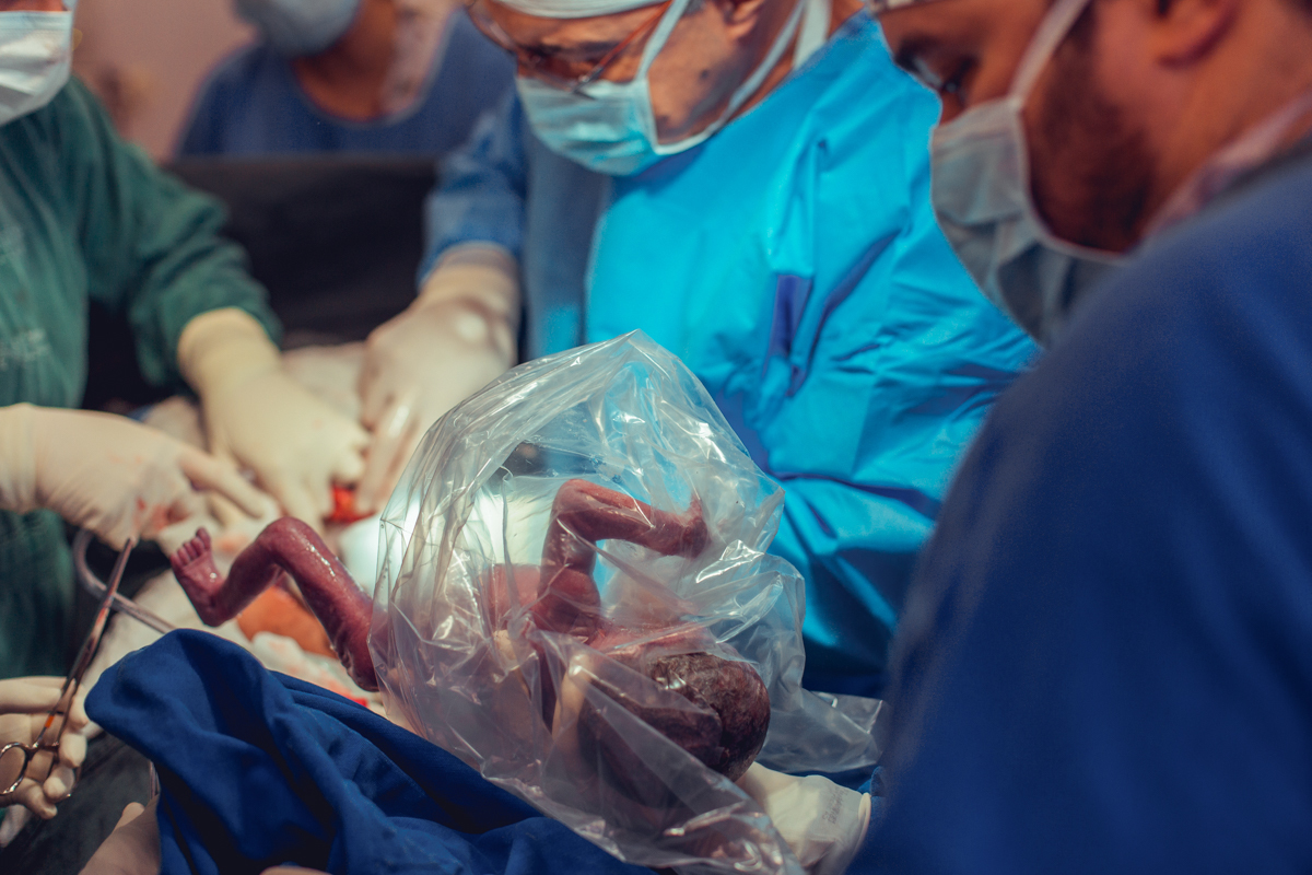 Eliomara Gomes eliomaria parto quadrigemeos riachao Maternidade de Referência José Maria de Magalhães Neto Senhoritas Fotografia Salvador 3 meninas e 1 menino Referencia Alto Risco Prematuro