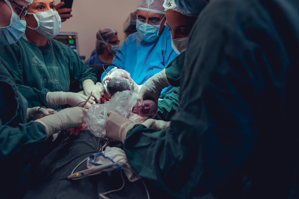 Eliomara Gomes eliomaria parto quadrigemeos riachao Maternidade de Referência José Maria de Magalhães Neto Senhoritas Fotografia Salvador 3 meninas e 1 menino Referencia Alto Risco Prematuro