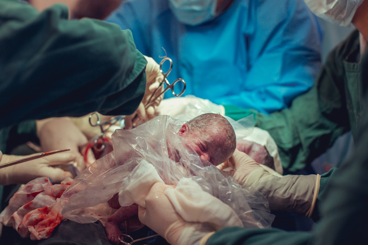 Eliomara Gomes eliomaria parto quadrigemeos riachao Maternidade de Referência José Maria de Magalhães Neto Senhoritas Fotografia Salvador 3 meninas e 1 menino Referencia Alto Risco Prematuro