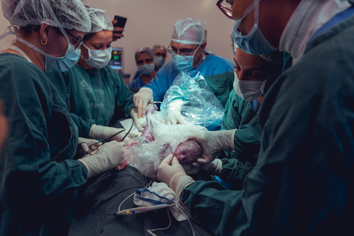 Eliomara Gomes eliomaria parto quadrigemeos riachao Maternidade de Referência José Maria de Magalhães Neto Senhoritas Fotografia Salvador 3 meninas e 1 menino Referencia Alto Risco Prematuro