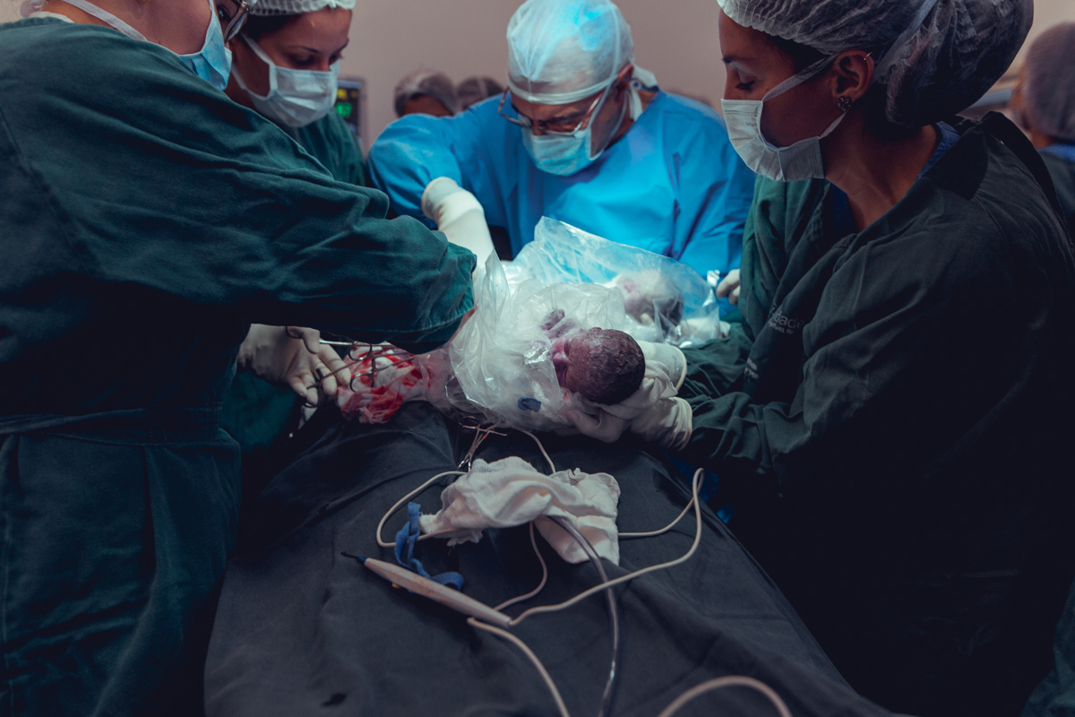 Eliomara Gomes eliomaria parto quadrigemeos riachao Maternidade de Referência José Maria de Magalhães Neto Senhoritas Fotografia Salvador 3 meninas e 1 menino Referencia Alto Risco Prematuro