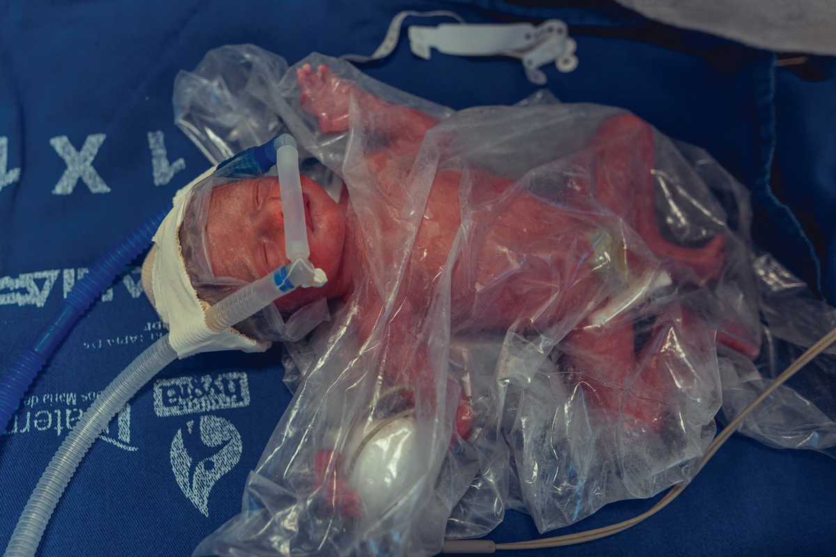 Eliomara Gomes eliomaria parto quadrigemeos riachao Maternidade de Referência José Maria de Magalhães Neto Senhoritas Fotografia Salvador 3 meninas e 1 menino Referencia Alto Risco Prematuro