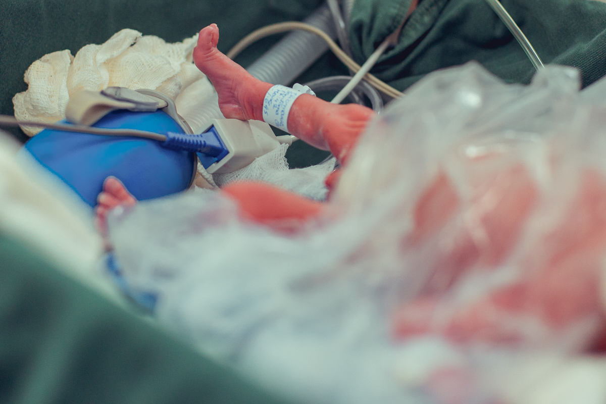 Eliomara Gomes eliomaria parto quadrigemeos riachao Maternidade de Referência José Maria de Magalhães Neto Senhoritas Fotografia Salvador 3 meninas e 1 menino Referencia Alto Risco Prematuro