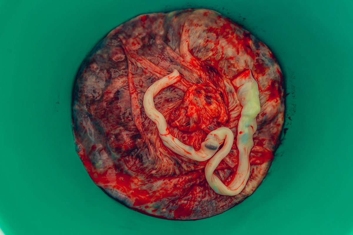 placenta sobreparto parto domiciliar salvador natural humanizado normal senhoritas fotografia nascimento