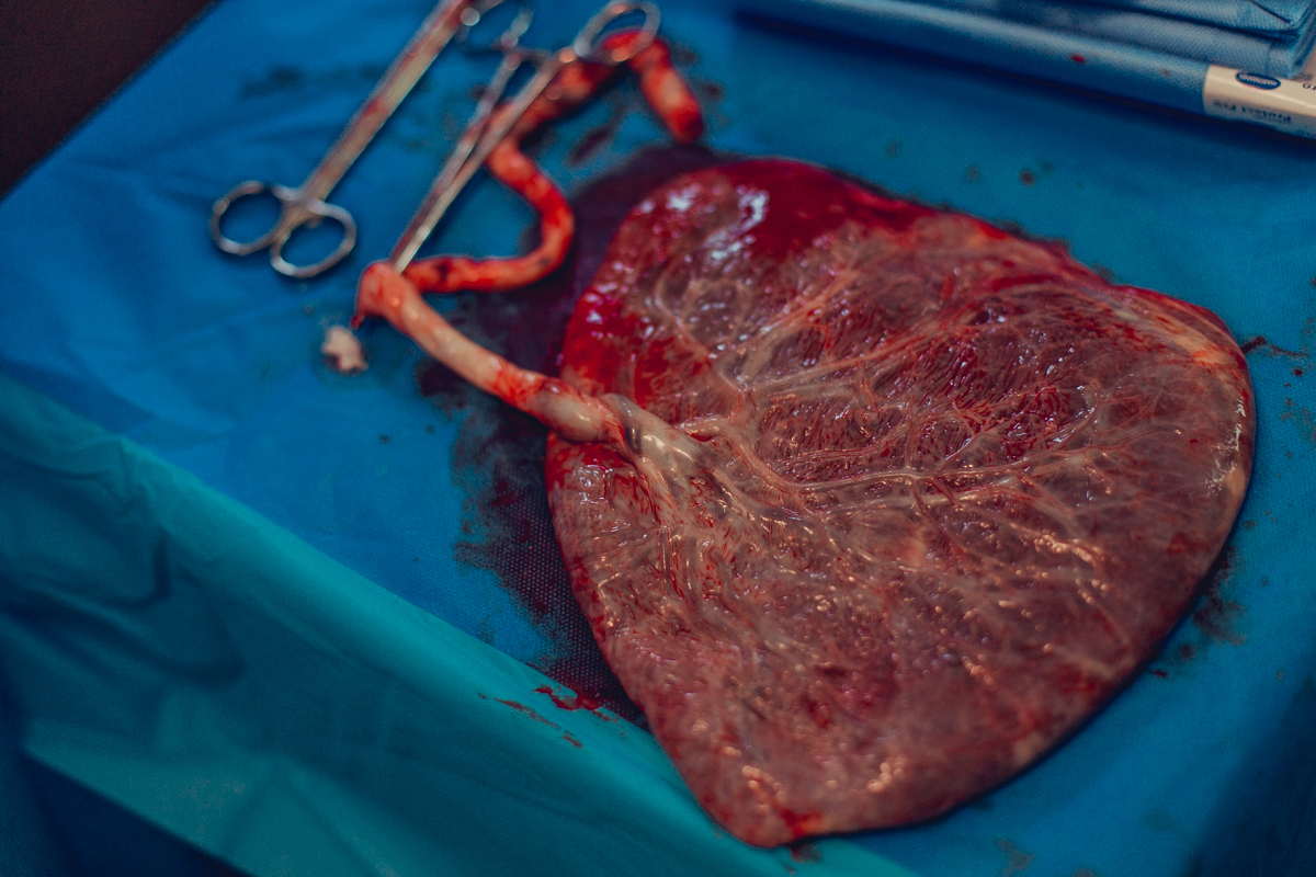 obstare salvador rodrigo lemos adriana monteiro parto normal natural hospital aliança hospitalar humanizado doula placenta