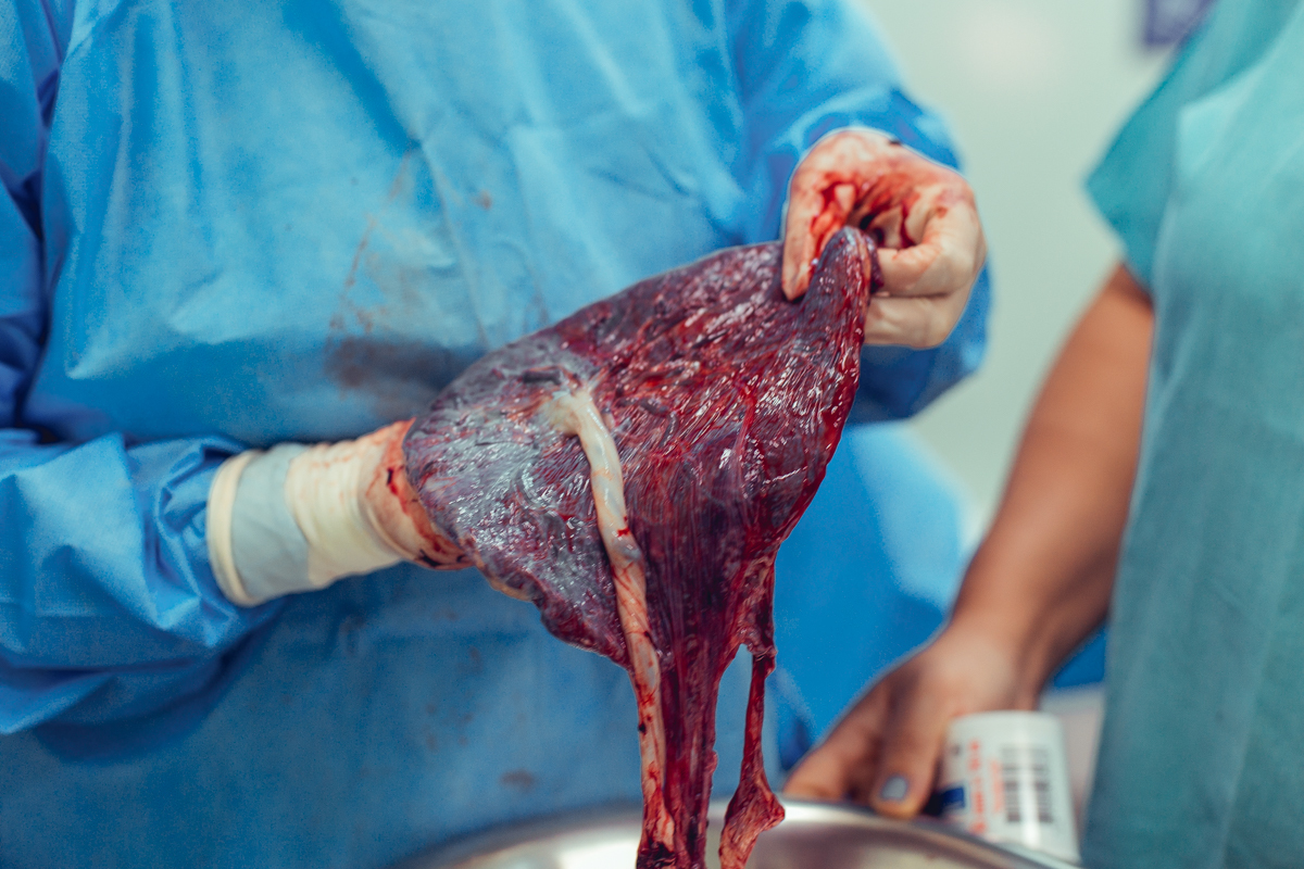 nascimento bento obstare salvador dr rodrigo dra adriana cesariana cesarea humanizada humanizacao natural normal analgesia obstetra patrica versao pelvico 