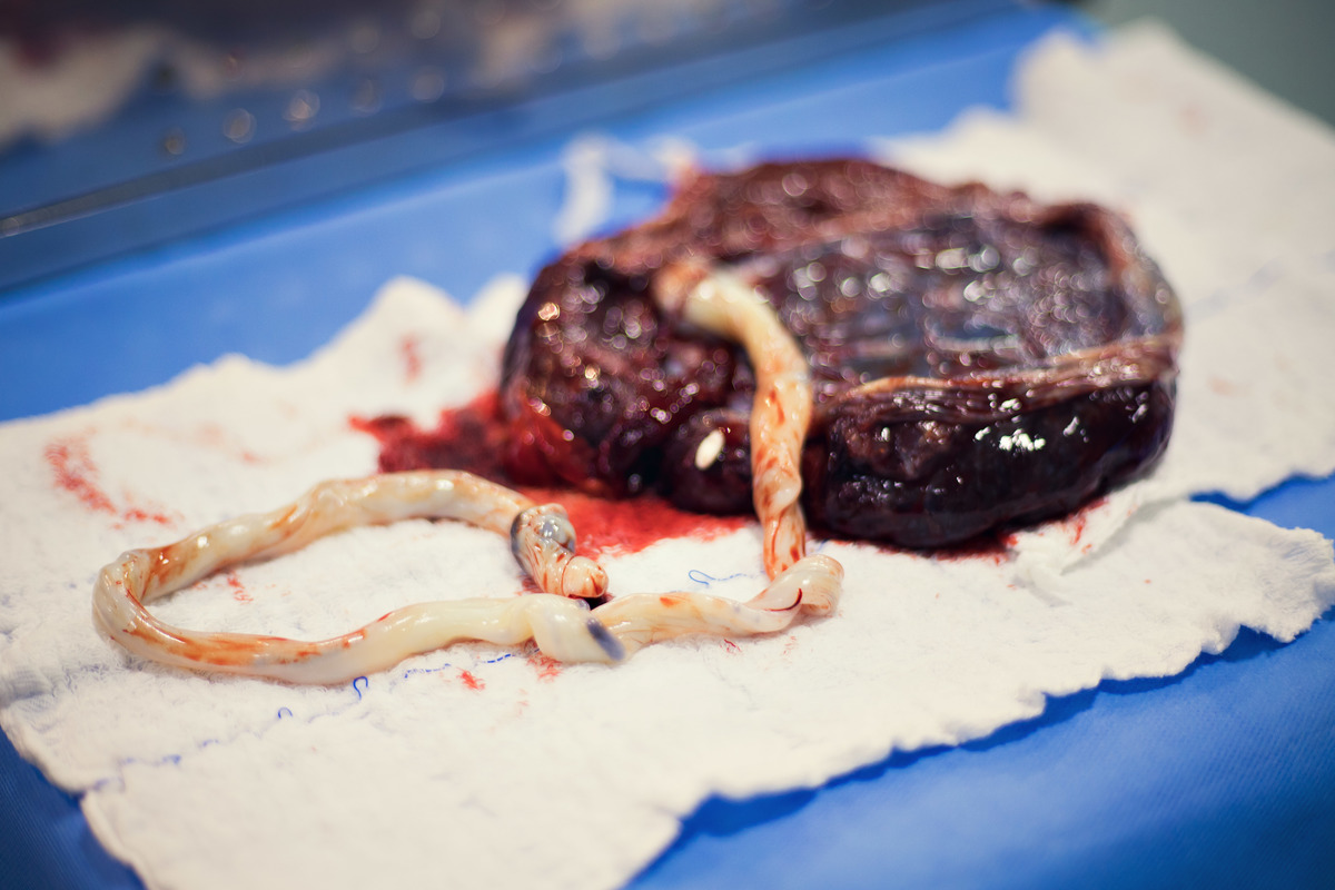 Fotografia de parto cesárea na Unimed Volta Redonda: Nascimento do Oliver.