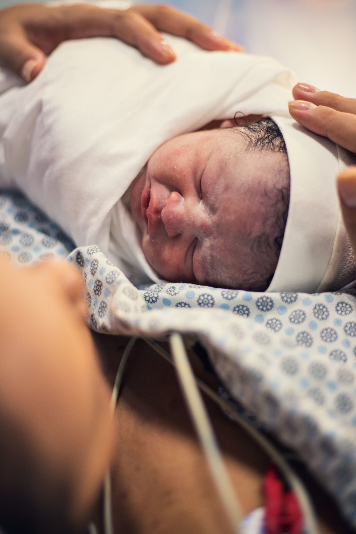 Fotografia de parto cesárea na Unimed Volta Redonda: Nascimento do Oliver.