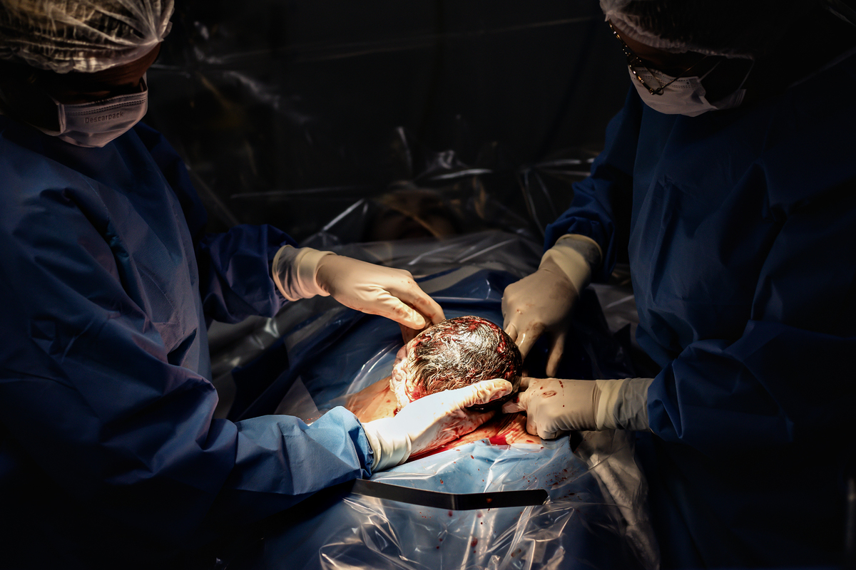 Fotografia de parto cesárea na Unimed Volta Redonda: Nascimento do Miguel.