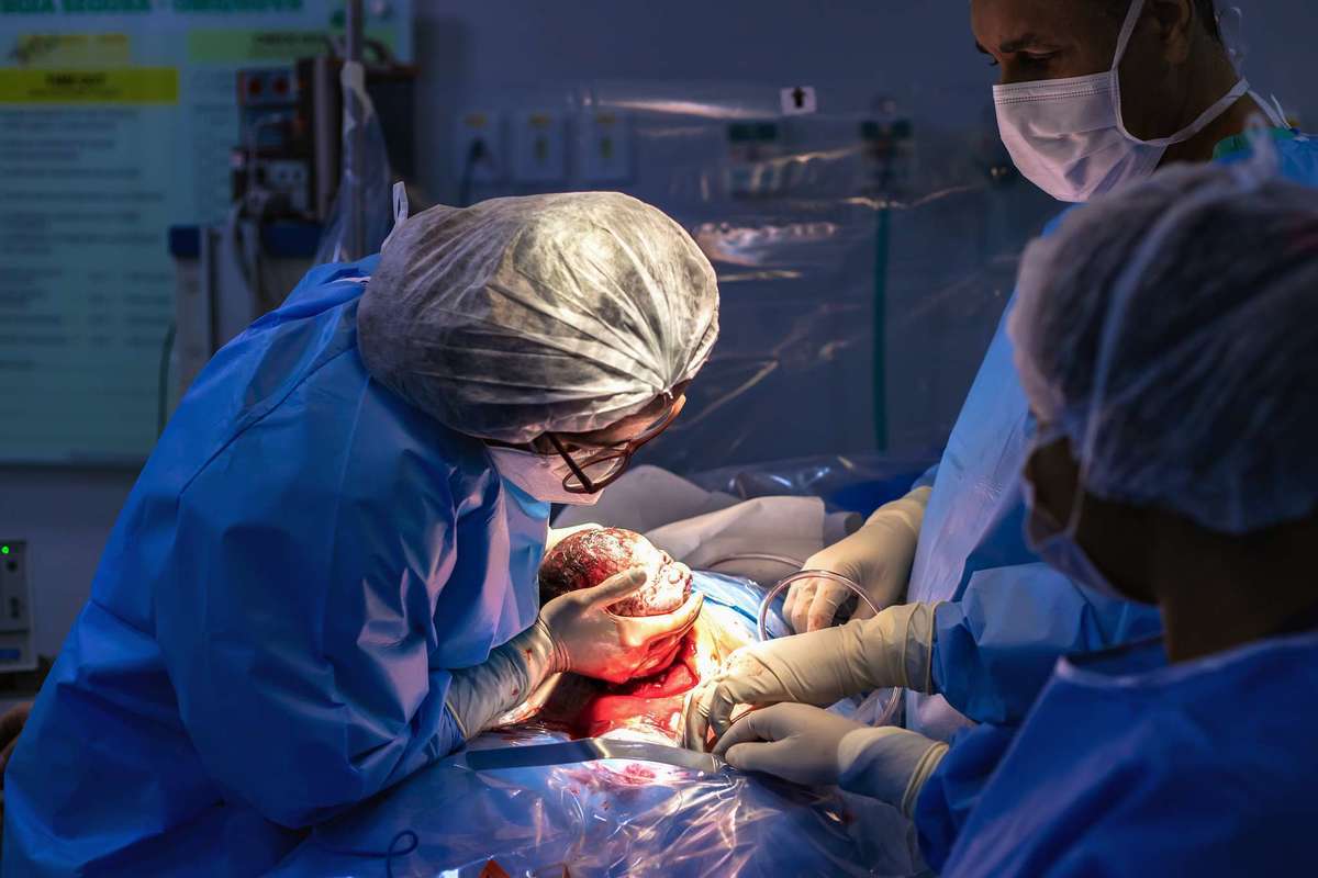 Fotografia de parto cesárea na Unimed Volta Redonda: Nascimento da Laura.