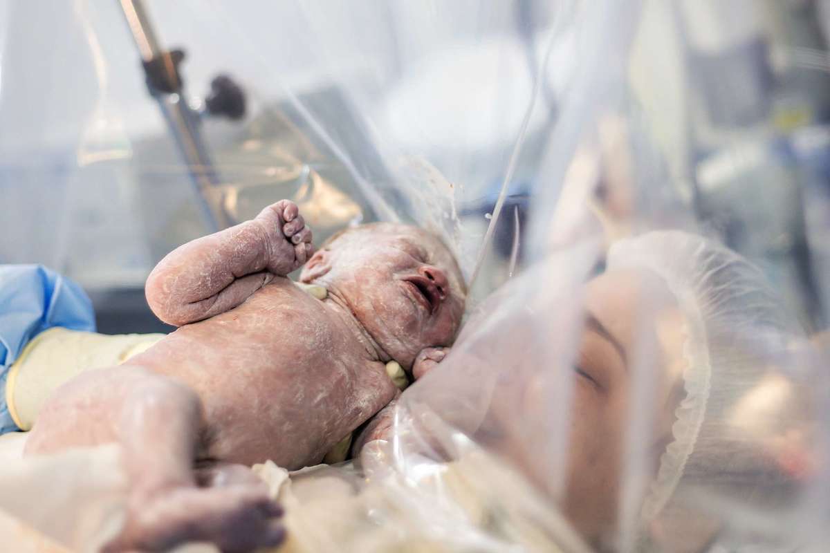 Fotografia de parto cesárea na Unimed Volta Redonda: Nascimento da Laura.
