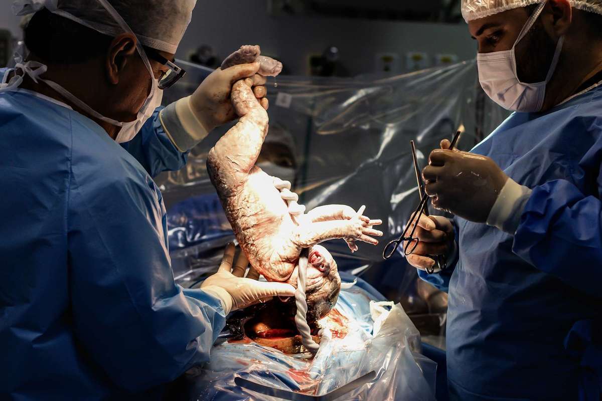Fotografia de parto cesárea na Unimed Volta Redonda: Nascimento da Lyvía.
