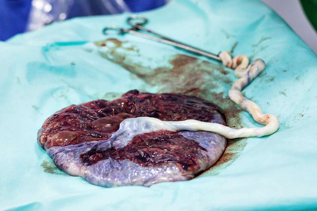 Fotografia de parto cesárea na Unimed Volta Redonda: Nascimento da Lyvía.