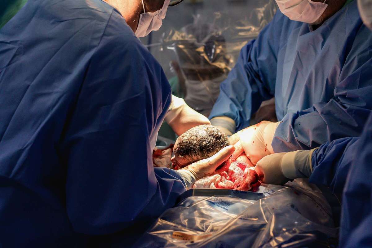 Fotografia de parto cesárea na Unimed Volta Redonda: Nascimento do Noah.