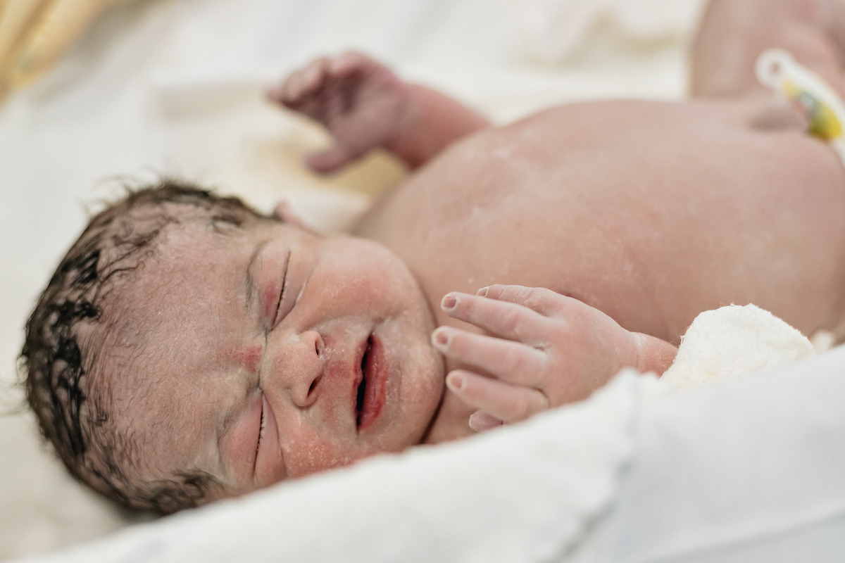 Fotografia de parto cesárea na Unimed Volta Redonda: Nascimento da Rebeca, acompanhada pelo obstetra Dr. Ricardo e pediatra Dra. Alanê.