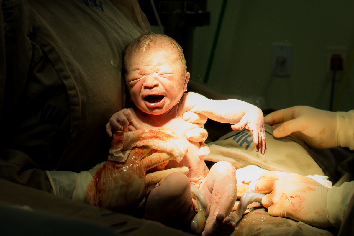 Fotografia de parto cesárea no Hinja Volta Redonda: Nascimento do Gabriel.