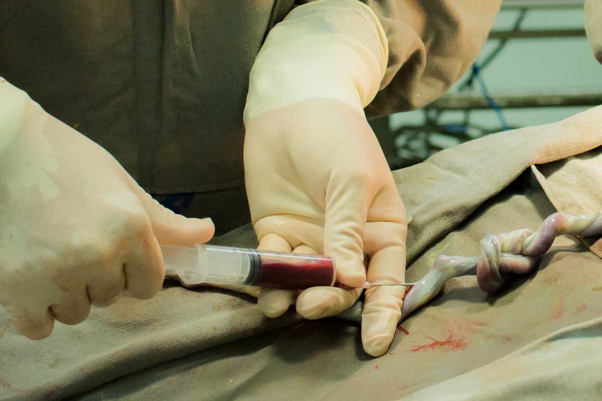 Fotografia de parto cesárea na Unimed Volta Redonda: Nascimento do Pedro.