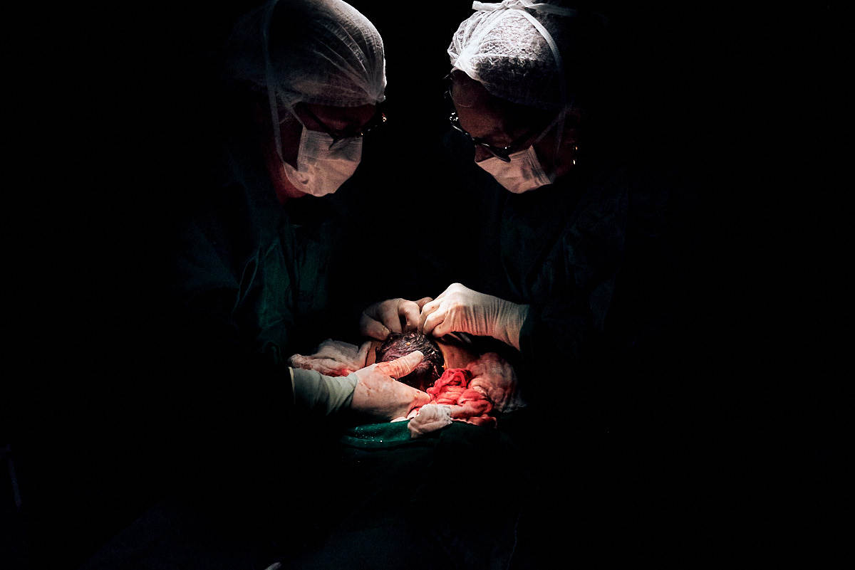 fotografia de parto, foto preto e branco, fotografia humana, 4Mãos fotografias