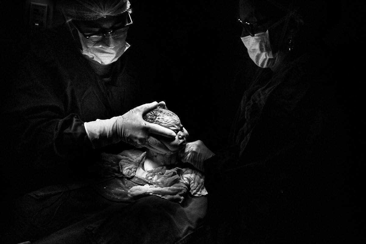 fotografia de parto, foto preto e branco, fotografia humana, 4Mãos fotografias