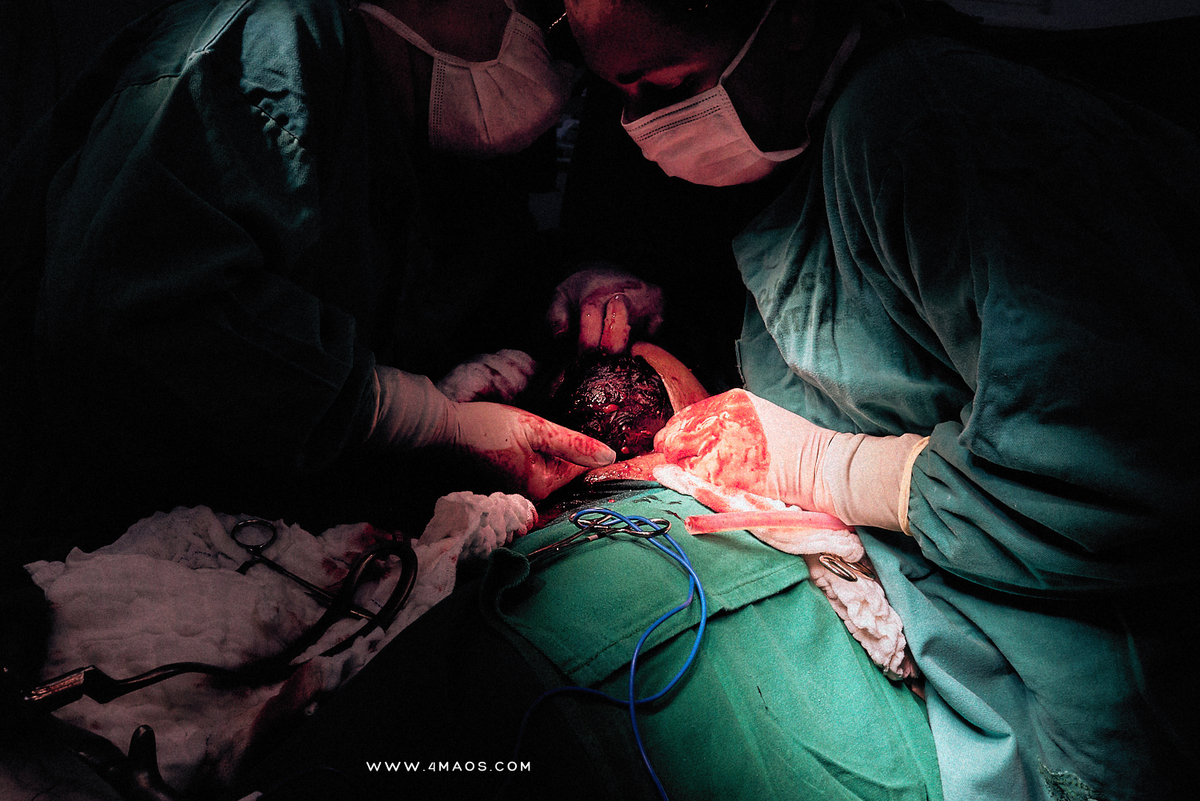 parto de Kamila a espera de Matheus no Hopital Santa Clara, parto cesária, fotografia documental por 4Mãos Fotografias