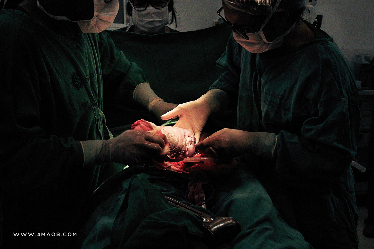 Parto Priscila campina grande santa clara